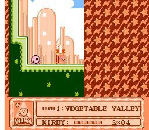 Hoshi no Kirby: Yume no Izumi no Monogatari (JP)